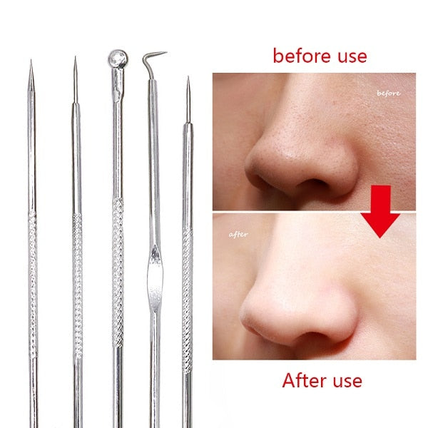 Blackhead Acne  Extractor Remover