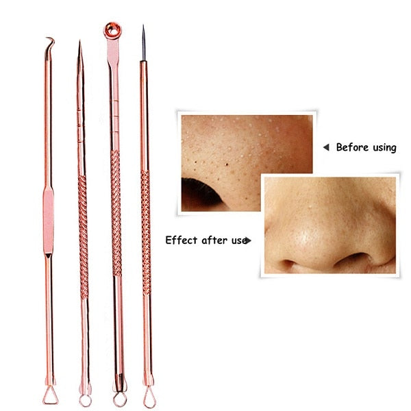 Blackhead Acne  Extractor Remover