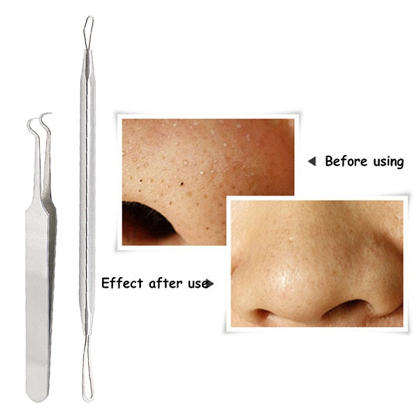 Blackhead Acne  Extractor Remover