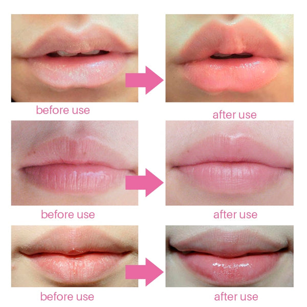 Lip Plumper Crystal Collagen Lip Mask Pads Moisture