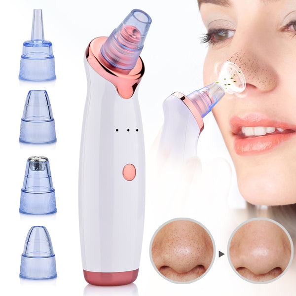 Blackhead Remover Vacuum Pore Cleaner Suction